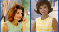 What Is Wrong With Jackie Kennedy Teeth?