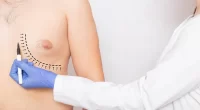 How To Get Rid Of Gynecomastia With Exercise: Unveiling the Path