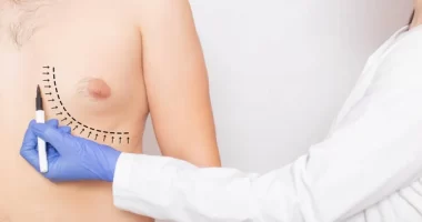 How To Get Rid Of Gynecomastia With Exercise: Unveiling the Path