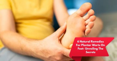 6 Natural Remedies For Plantar Warts On Feet