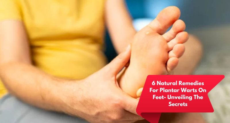 6 Natural Remedies For Plantar Warts On Feet