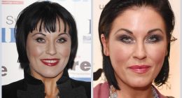 Did Jessie Wallace Undergo Plastic Surgery?