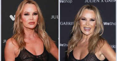 Has Amanda Holden Undergone Weight Loss Surgery?