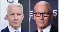 Has Anderson Cooper Undergone Plastic Surgery?