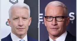 Has Anderson Cooper Undergone Plastic Surgery?
