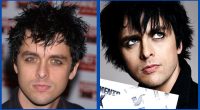 Has Billie Joe Armstrong Undergone Plastic Surgery?