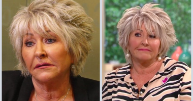 Has Maggie Oliver Done Plastic Surgery? Net Worth Explored
