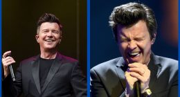 Rick Astley Plastic Surgery Before And After: What Happened?