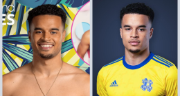 What Is Wrong With Toby Love Island Teeth 2024? Health Update