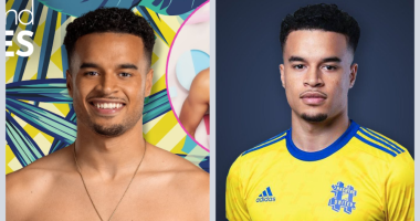 What Is Wrong With Toby Love Island Teeth 2024? Health Update