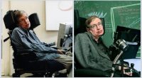 What Was Wrong With Stephen Hawking Teeth?