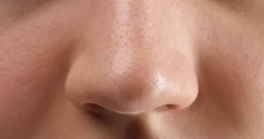 Navigating Post-Rhinoplasty Discontent: A Comprehensive Guide