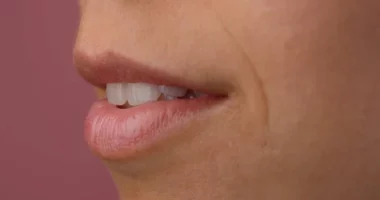 The Ultimate Guide to Preventing Dry Mouth After Rhinoplasty