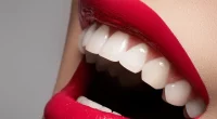 6 Different Methods for Teeth Whitening for 2024
