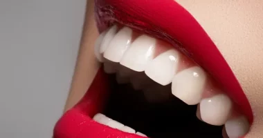 6 Different Methods for Teeth Whitening for 2024