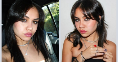 Did Tara Yummy Get A Nose Job in 2024? Before And After