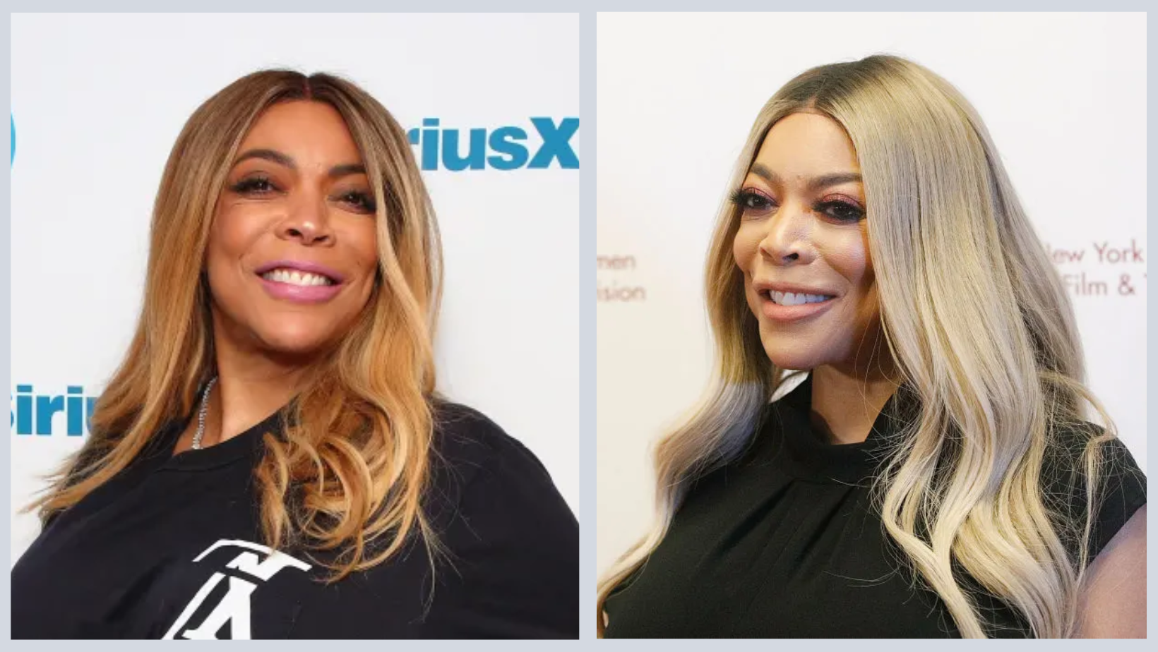 Did Wendy Williams Undergo Plastic Surgery On Her Nose?