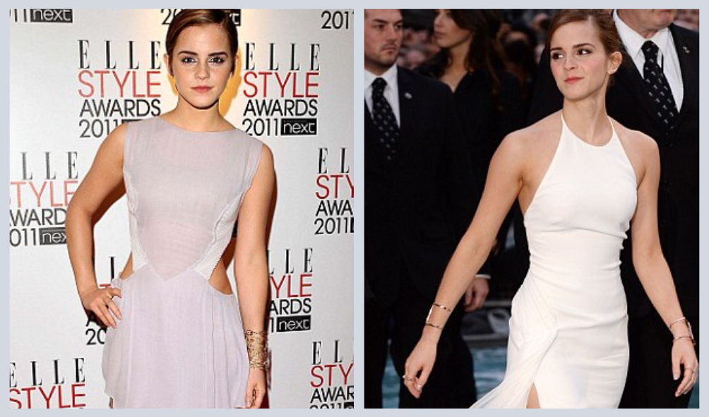 Does Emma Watson Suffering Eating Disorder: Weight Gain Before And After