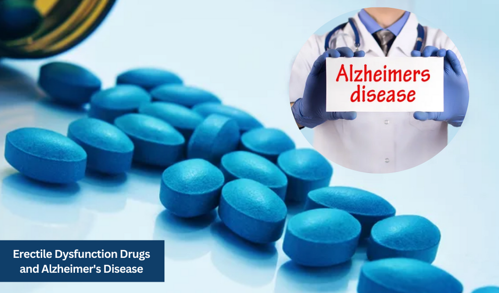 Erectile Dysfunction Drugs and Alzheimer's Disease: A Glimmer of Hope from Recent Research
