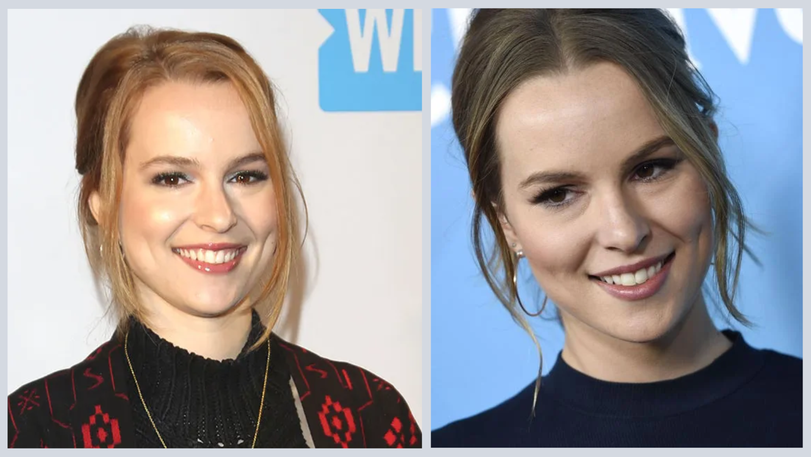 Has Bridgit Mendler Done Plastic Surgery?