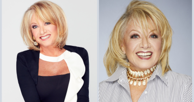 Has Elaine Paige Done Nose Job Before Surgery?