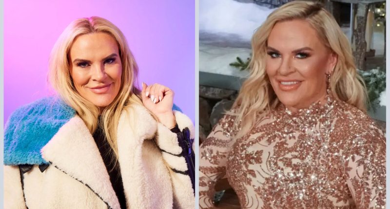 Heather Gay Plastic Surgery Before And After: What Happened?