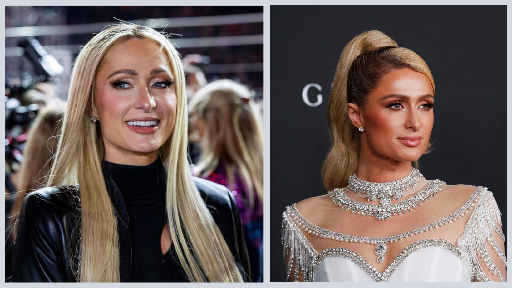 Paris Hilton Nose Job: Did She Undergo Plastic Surgery?