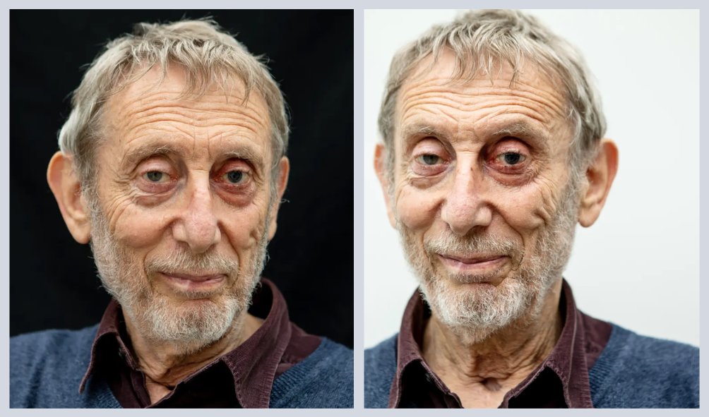 What Illness Does Michael Rosen Have in 2024: Is He Sick? Health Update