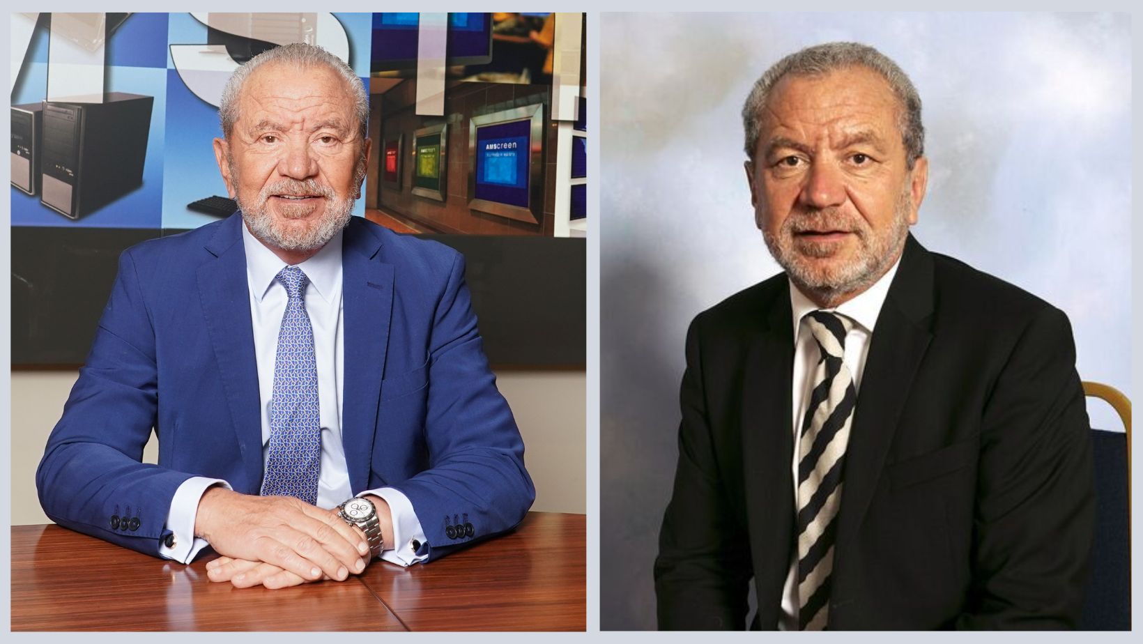 What Plastic Surgery Did Alan Sugar Undergo?