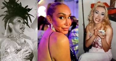 Was Cecilia Gentili Undergo Nose Job Surgery? Illness And Health Issues