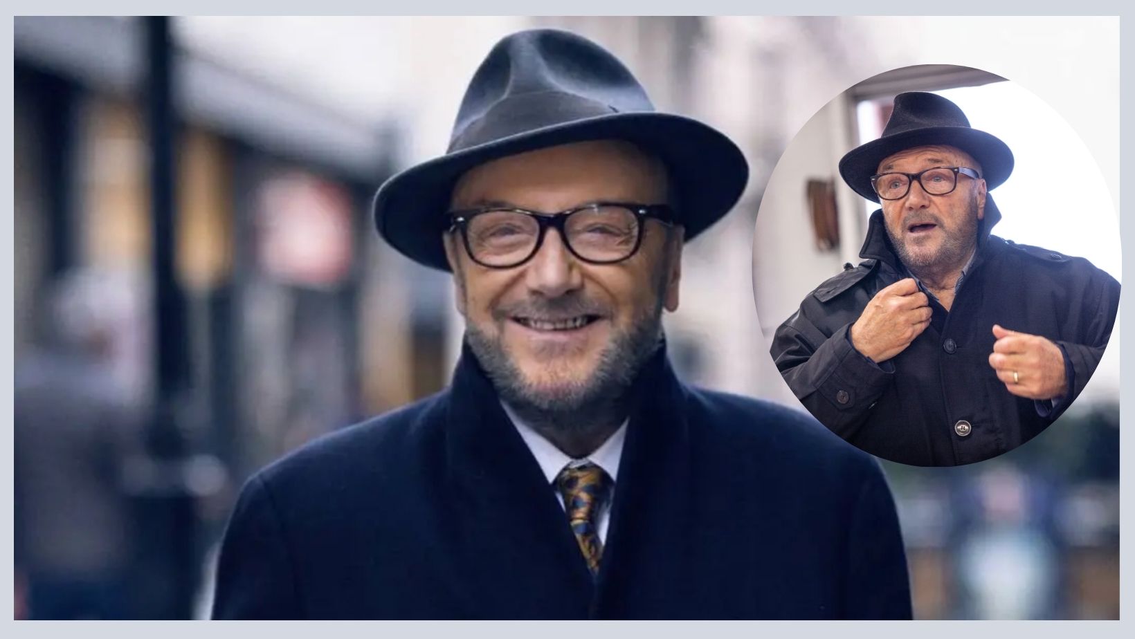 george galloway plastic surgery Image 2
