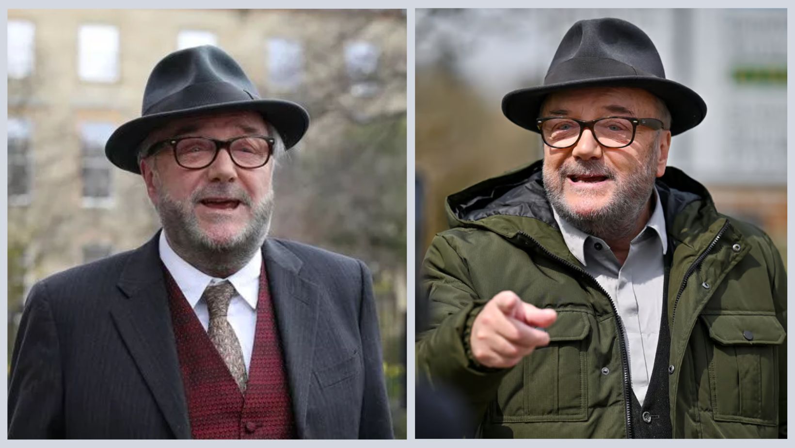 What Plastic Surgery Did George Galloway Undergo?