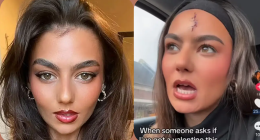 Megan Clarke’s “Harry Potter” Scar Explained on Love Island