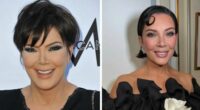 Kris Jenner Breaks Silence on Dramatic Facelift