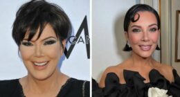 Kris Jenner Breaks Silence on Dramatic Facelift