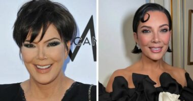 Kris Jenner Breaks Silence on Dramatic Facelift
