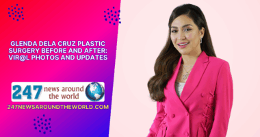 Glenda Dela Cruz Plastic Surgery Before and After