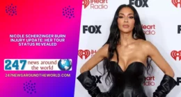 Nicole Scherzinger Burn Injury Update Her Tour Status Revealed