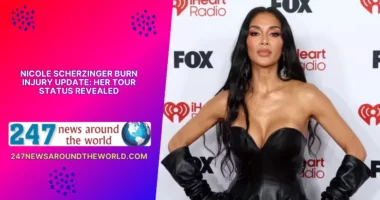 Nicole Scherzinger Burn Injury Update Her Tour Status Revealed