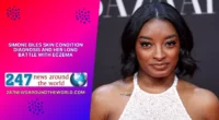 Simone Biles Skin Condition Diagnosis and Her Long Battle With Eczema