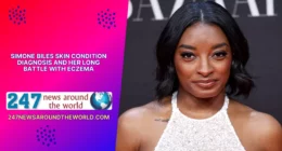 Simone Biles Skin Condition Diagnosis and Her Long Battle With Eczema