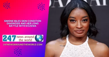Simone Biles Skin Condition Diagnosis and Her Long Battle With Eczema